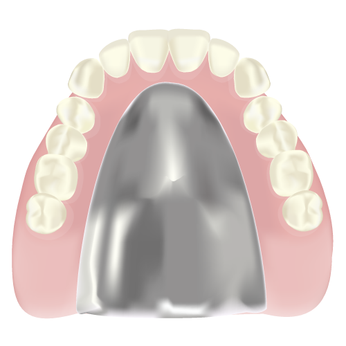 金属床義歯(自費診療)